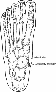 Navicular and accessory navicular location in the foot