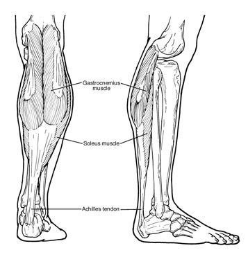Equinus is often due to tight Achilles tendon or calf muscles
