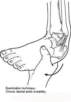 Examination technique for chronic ankle instability