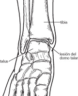 Articulatia cotului – normal vs. patologic