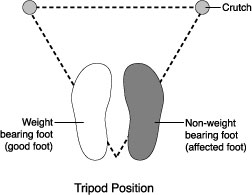 Tripod position for crutches