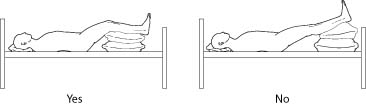 Correct elevation for acute leg inflammation involves support under calves and knees partially bent.