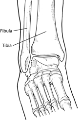 Diagram of the front of the ankle indicating the location of the fibula and tibia