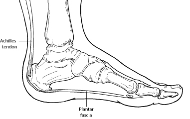 Heel Pain (Plantar Fasciitis) - Foot 