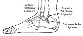 Diagram of an ankle indicating location of ligaments that may be injured in an ankle sprain