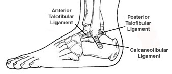 Ankle Sprain - Foot Health Facts