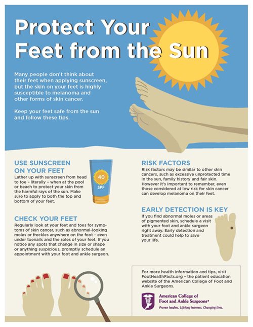 Protect Your Feet from the Sun Infographic